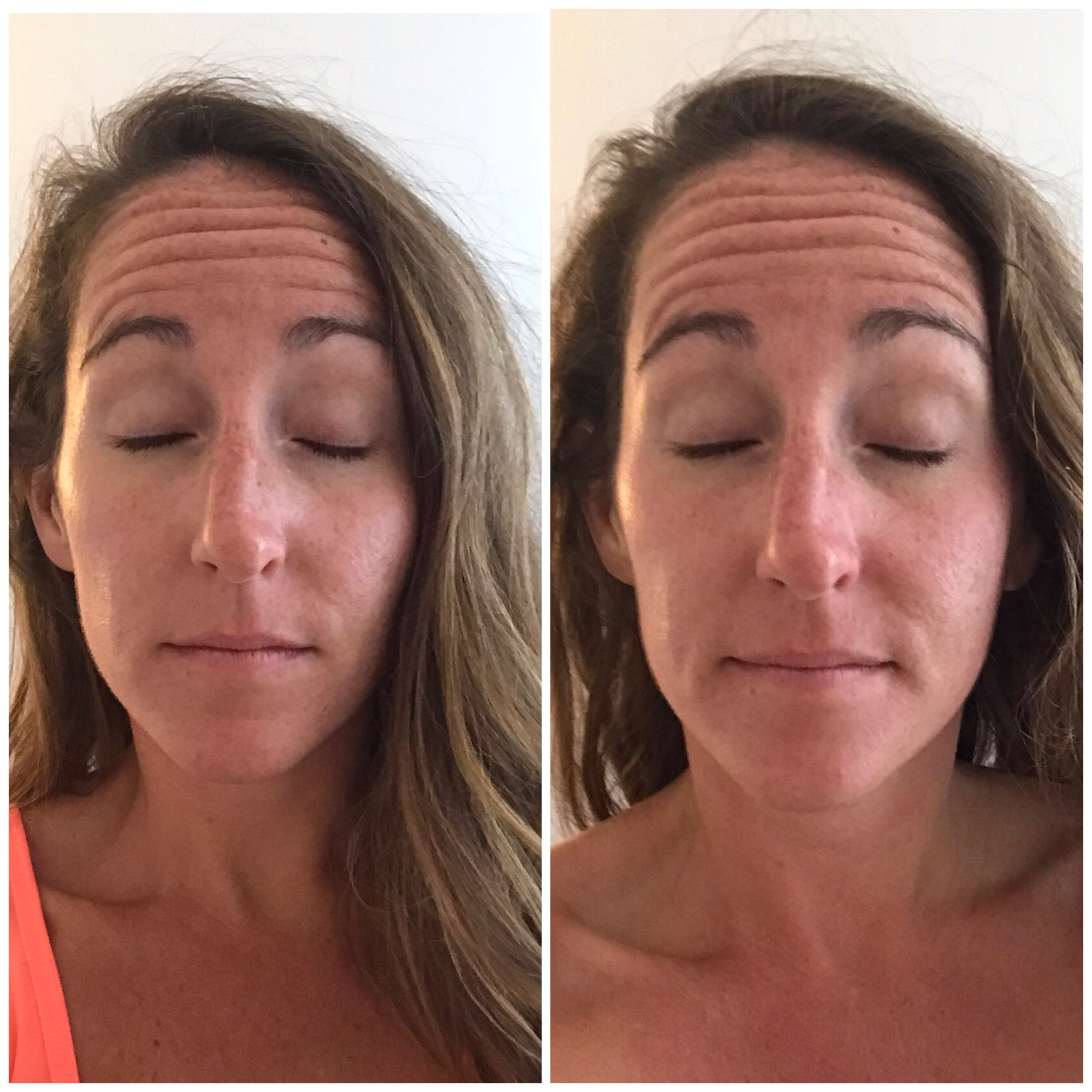 My Experience Getting A HydraFacial At Honolulu Spa + Wellness - Best Facial Honolulu - Honolulu Facial - Honolulu Spa - HydraFacial Near Me Honolulu - HydraFacial Before and After - HydraFacial Results - Spa Honolulu - Honolulu Spa and Wellness
